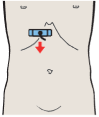 Probe position, Medial and anterior hepatic segments, opening of hepatic veins