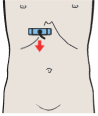 Probe position, Medial and anterior hepatic segments, left portal vein branch, caudate lobe