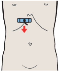 Probe position, Medial and anterior hepatic segments, right and left portal vein branches