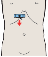 Probe position, Medial and anterior hepatic segments, quadrate lobe, ligamentum teres, portal vein