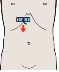 Probe position, Medial and anterior hepatic segments, quadrate lobe, ligamentum teres, portal vein