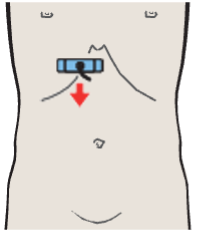 Probe position, Medial and anterior hepatic segments, quadrate lobe, ligamentum teres, gallbladder