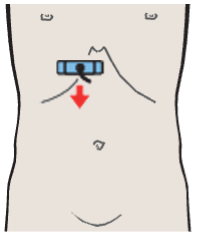 Probe position, Inferior border of liver, kidney, gallbladder, ligamentum teres