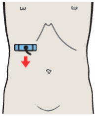 Probe position, Posterior segment, portal vein