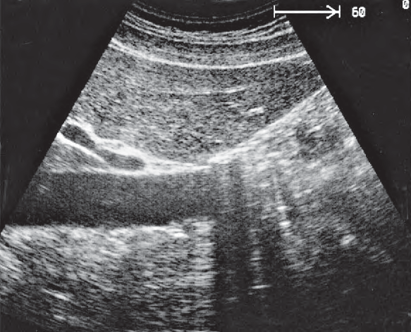 Duodenum ultrasound image