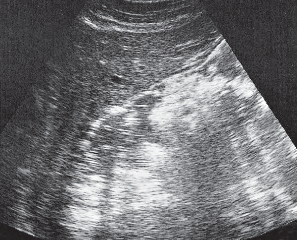 Body of stomach ultrasound image, Body of stomach, liver