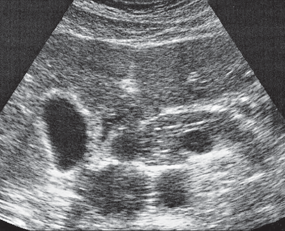 Duodenum ultrasound image, Antrum, duodenum, liver, pancreas, gallbladder