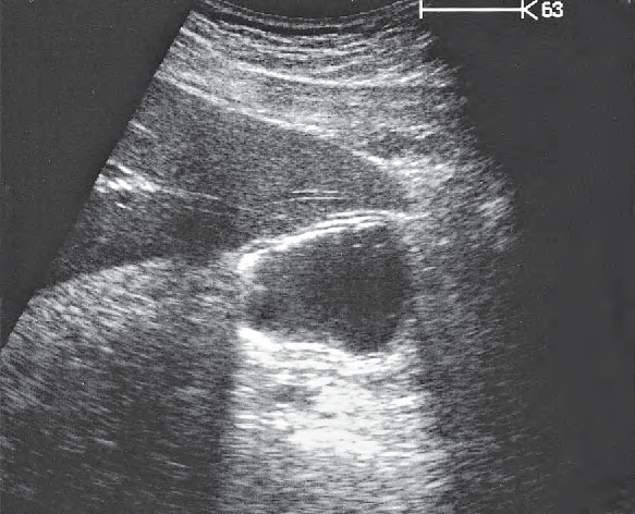 Antrum of stomach ultrasound image, Layers of gastric wall