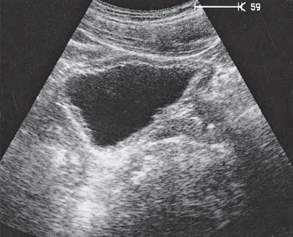 Rectum Ultrasound Anatomy