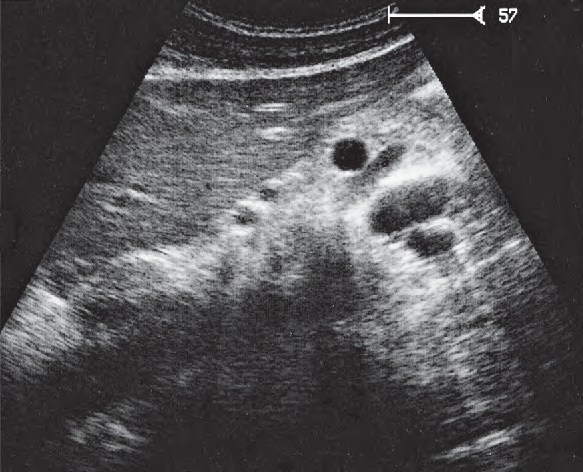 Left renal artery ultrasound image, Splenic artery and vein, renal artery and vein