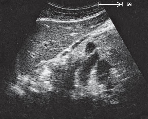 Stomach ultrasound image, Splenic artery and vein, renal artery and vein
