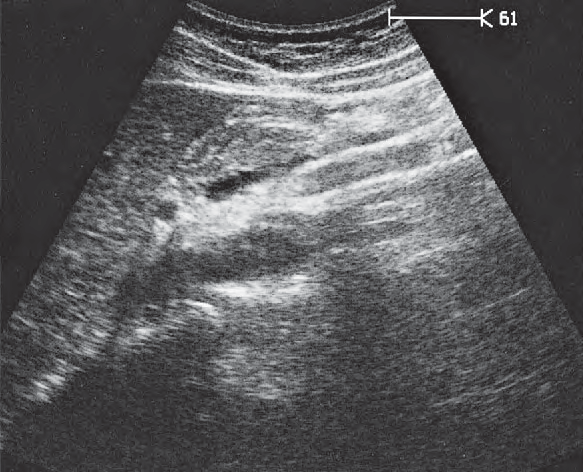 Stomach ultrasound image, Hepatic artery and splenic vein