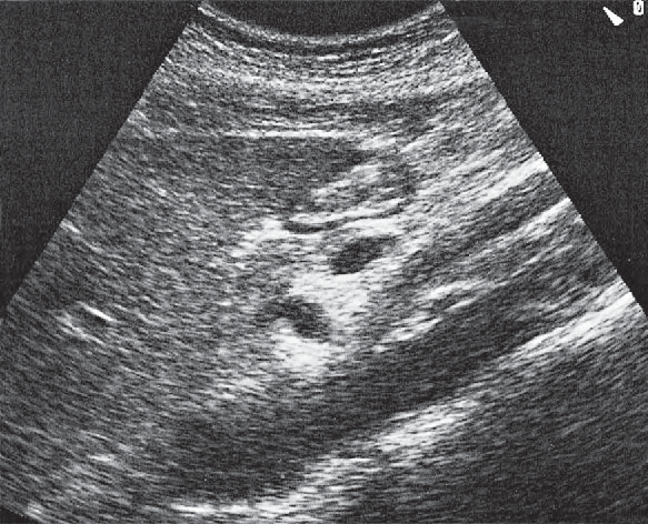 Stomach ultrasound image, Hepatic artery, superior mesenteric artery, and splenic vein
