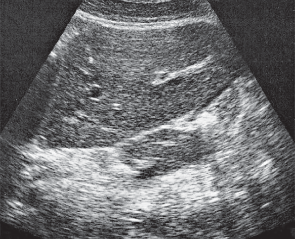 Heart Ultrasound Anatomy
