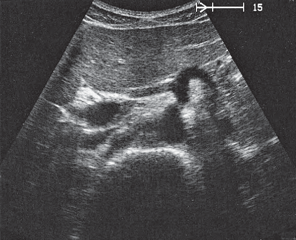 Splenic Artery Ultrasound Anatomy